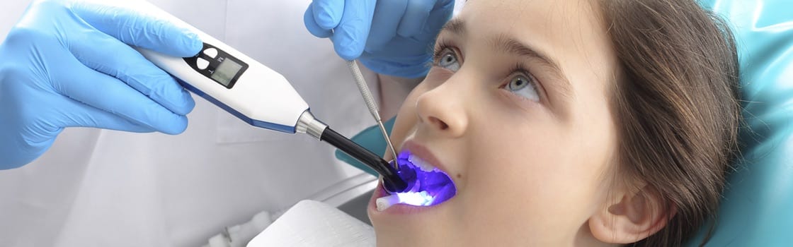 Dental Sealants Simi Valley CA