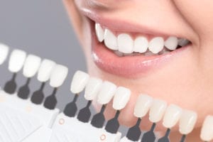 Teeth Whitening Simi Valley, CA