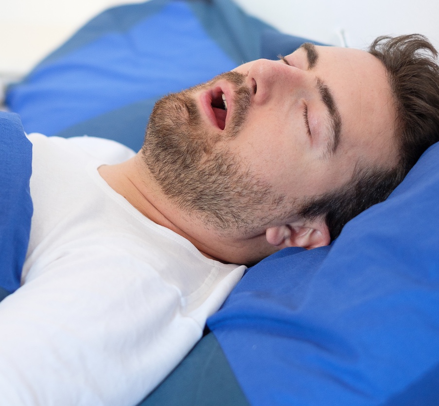 man sleeping with mouth open, possibly experiencing sleep apnea