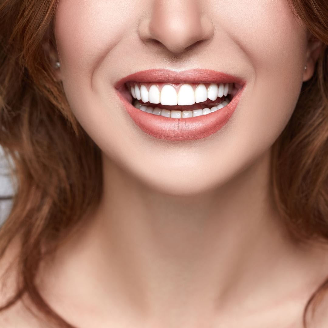 Fluoride Reduction