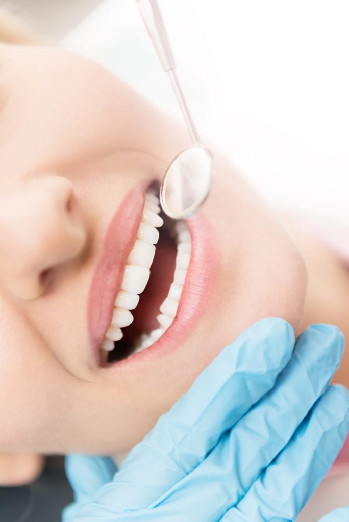 Vertical close-up image of woman having dental examination of tooth colored fillings.